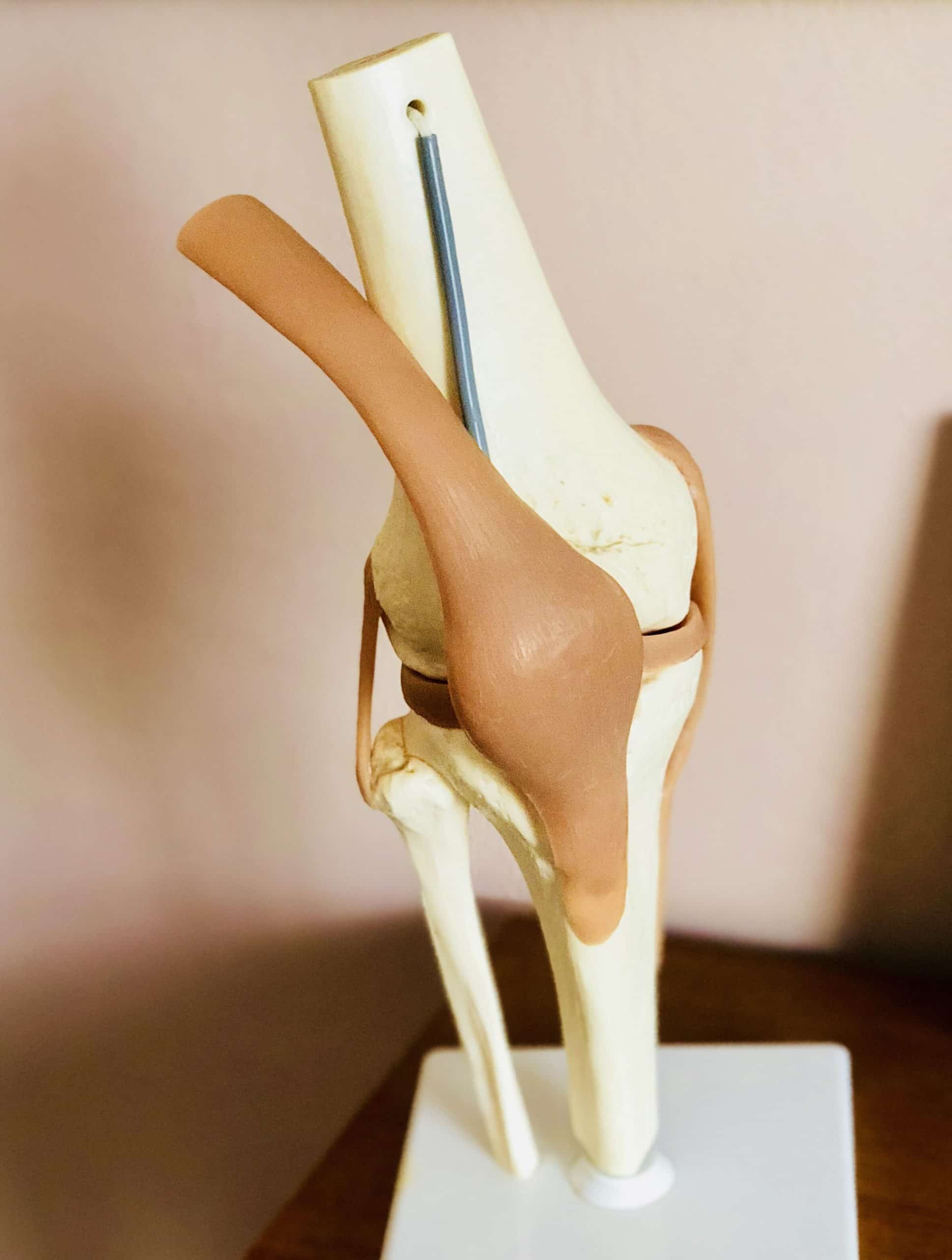 A model of a human knee