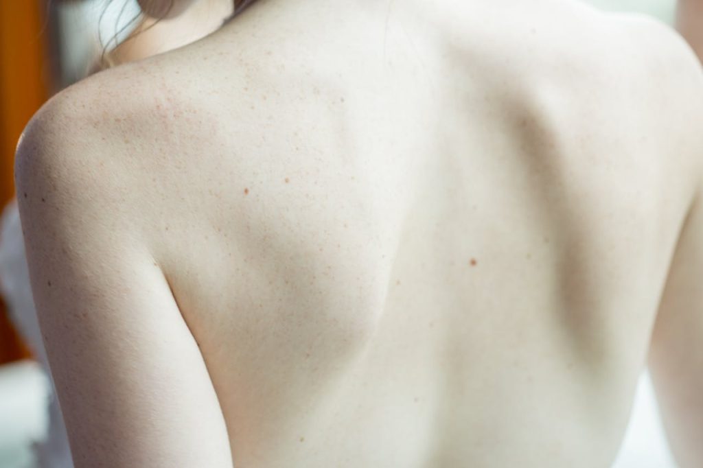 Beneficios de la fisioterapia en lesiones de columna - ITGO