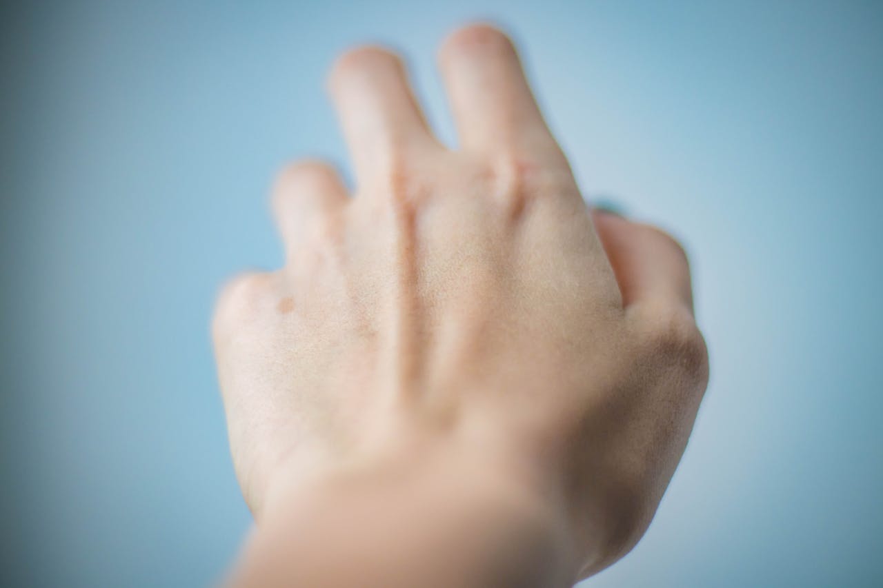 Estas son las diferencias entre artritis y artrosis