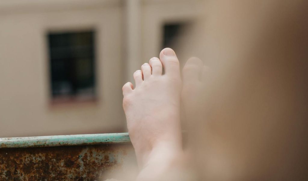 Hallux Valgus y cirugía ¿Es siempre necesaria