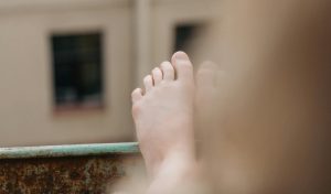 Hallux Valgus y cirugía ¿Es siempre necesaria